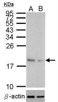 Western Blot: SOD1/Cu-Zn SOD Antibody [NBP2-20534]