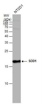 Western Blot: SOD1/Cu-Zn SOD Antibody [NBP2-20534]