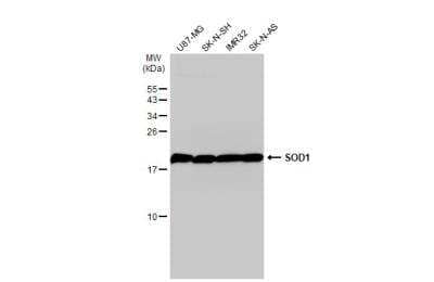 Western Blot: SOD1/Cu-Zn SOD Antibody [NBP2-20534]