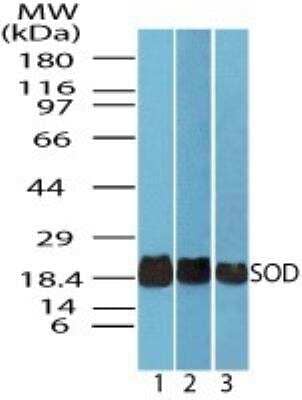 Western Blot: SOD1/Cu-Zn SOD Antibody [NBP2-24915]