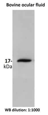 Western Blot: SOD1/Cu-Zn SOD Antibody [NBP2-24915]