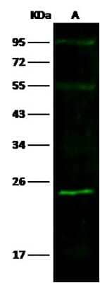 Western Blot: SOD2/Mn-SOD Antibody (001) [NBP2-90138]