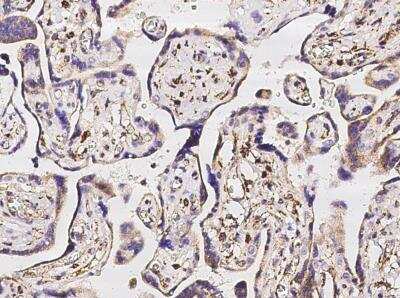 Immunohistochemistry-Paraffin: SOD2/Mn-SOD Antibody (012) [NBP2-90139]
