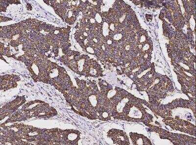 Immunohistochemistry-Paraffin: SOD2/Mn-SOD Antibody (012) [NBP2-90139]