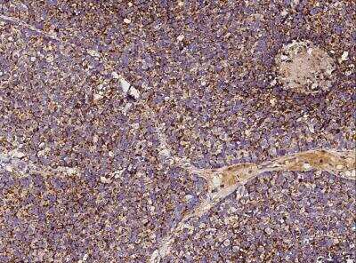 Immunohistochemistry-Paraffin: SOD2/Mn-SOD Antibody (012) [NBP2-90139]