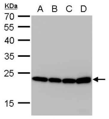 Western Blot: SOD2/Mn-SOD Antibody (582) [NBP2-43795]