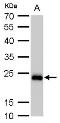 Western Blot: SOD2/Mn-SOD Antibody (582) [NBP2-43795]