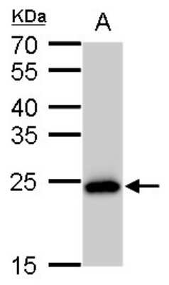 Western Blot: SOD2/Mn-SOD Antibody (582) [NBP2-43795]
