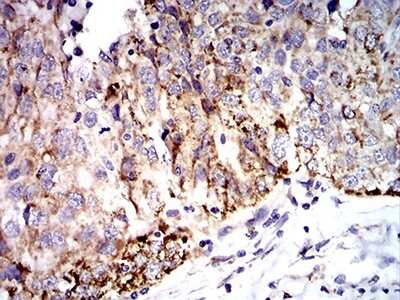 Immunohistochemistry: SOD2/Mn-SOD Antibody (8H3D2) - BSA Free [NBP2-61883]