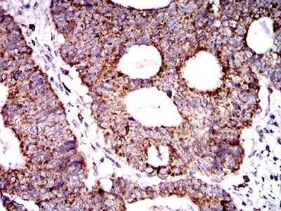 Immunohistochemistry: SOD2/Mn-SOD Antibody (8H3D2) - BSA Free [NBP2-61883]