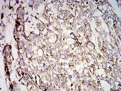 Immunohistochemistry: SOD2/Mn-SOD Antibody (8H3F9) - BSA Free [NBP2-61885]