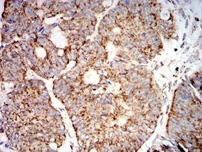 Immunohistochemistry: SOD2/Mn-SOD Antibody (8H3F9) - BSA Free [NBP2-61885]