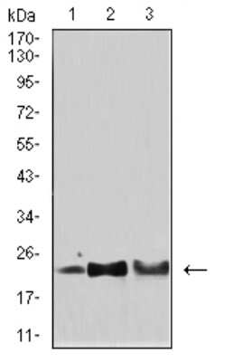 Western Blot: SOD2/Mn-SOD Antibody (8H3F9)BSA Free [NBP2-61885]