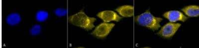 Immunocytochemistry/ Immunofluorescence: SOD2/Mn-SOD Antibody [NB100-1992]