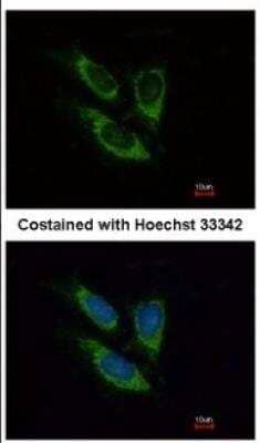 Immunocytochemistry/ Immunofluorescence: SOD2/Mn-SOD Antibody [NBP2-20535]