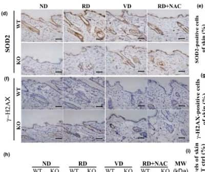 Immunohistochemistry: SOD2/Mn-SOD Antibody [NB100-1992]