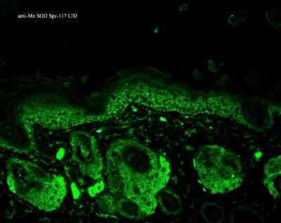 Immunohistochemistry: SOD2/Mn-SOD Antibody [NB100-1992]