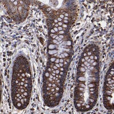 Immunohistochemistry-Paraffin: SOD2/Mn-SOD Antibody [NBP1-86169]