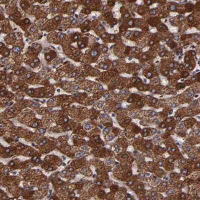 Immunohistochemistry-Paraffin: SOD2/Mn-SOD Antibody [NBP1-86169]