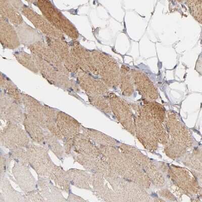 Immunohistochemistry-Paraffin: SOD2/Mn-SOD Antibody [NBP1-86169]