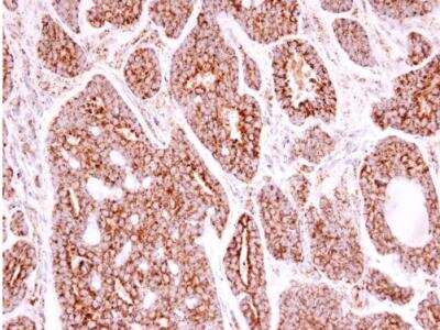 Immunohistochemistry-Paraffin: SOD2/Mn-SOD Antibody [NBP2-20535]