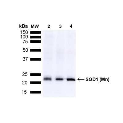 Western Blot: SOD2/Mn-SOD Antibody [NB100-1969]