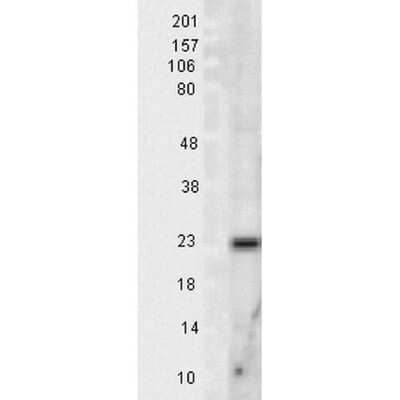 Western Blot: SOD2/Mn-SOD Antibody [NB100-1992]