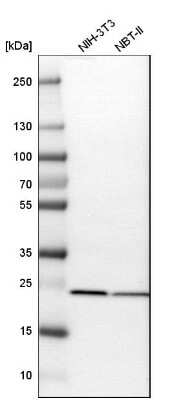 Western Blot: SOD2/Mn-SOD Antibody [NBP1-86169]