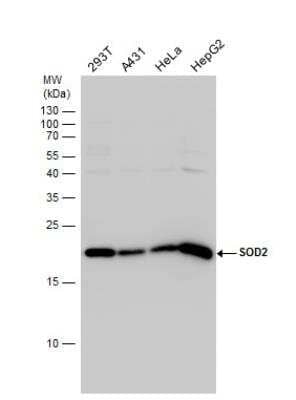 Western Blot: SOD2/Mn-SOD Antibody [NBP2-20535]