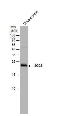 Western Blot: SOD2/Mn-SOD Antibody [NBP2-20535]