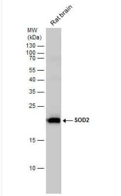 Western Blot: SOD2/Mn-SOD Antibody [NBP2-20535]