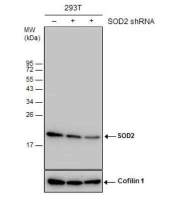 Western Blot: SOD2/Mn-SOD Antibody [NBP2-20535]