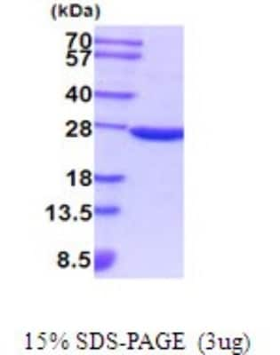 SDS-PAGE: Recombinant Mouse SOD2/Mn-SOD His Protein [NBP2-52079]