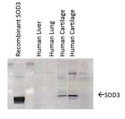 Western Blot: SOD3/EC-SOD Antibody (4GG11G6) [NBP1-22417]