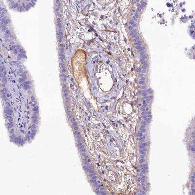 Immunohistochemistry-Paraffin: SOD3/EC-SOD Antibody [NBP2-38493]