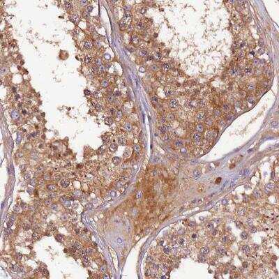 Immunohistochemistry-Paraffin: SOD3/EC-SOD Antibody [NBP2-38493]