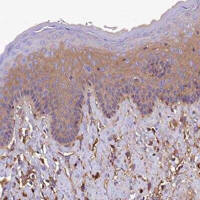 Immunohistochemistry-Paraffin: SOD3/EC-SOD Antibody [NBP2-38493]
