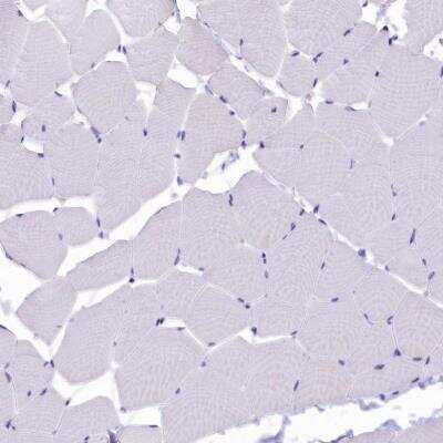 Immunohistochemistry-Paraffin: SOD3/EC-SOD Antibody [NBP2-38493]