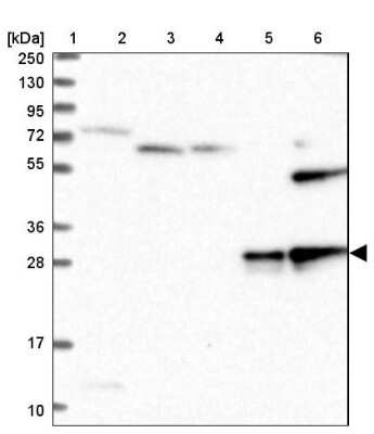 Western Blot: SOD3/EC-SOD Antibody [NBP2-38493]