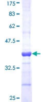 SDS-PAGE: Recombinant Human SOD3/EC-SOD GST (N-Term) Protein [H00006649-Q01]