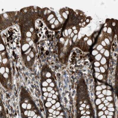 Immunohistochemistry-Paraffin: SODD/BAG4 Antibody [NBP1-87017]