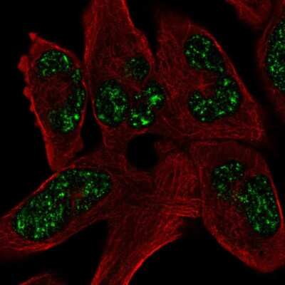 Immunocytochemistry/ Immunofluorescence: SOHLH1 Antibody [NBP2-56883]