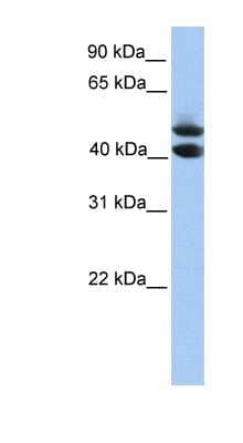 Western Blot: SOHLH1 Antibody [NBP1-56762]