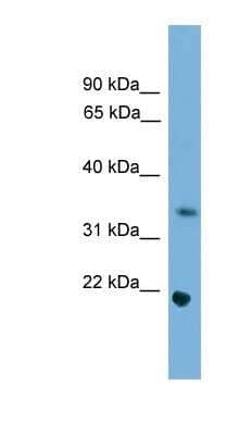 Western Blot: SOHLH1 Antibody [NBP1-80284]