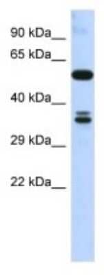 Western Blot: SOHLH1 Antibody [NBP3-10460]