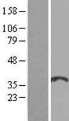 Western Blot: SOHLH1 Overexpression Lysate [NBL1-16336]