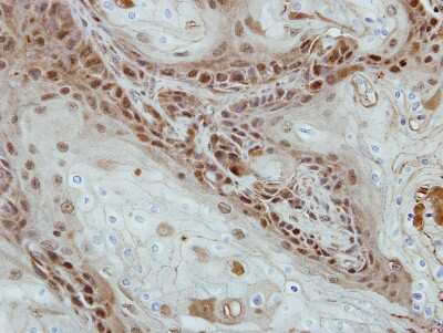 Immunohistochemistry-Paraffin: SOHLH2 Antibody [NBP2-20453]