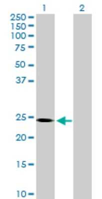 Western Blot: SOHLH2 Antibody [H00054937-B01P]