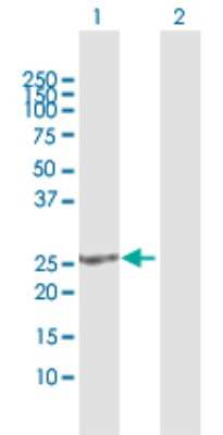 Western Blot: SOHLH2 Antibody [H00054937-D01P]