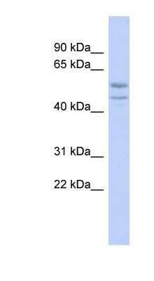 Western Blot: SOHLH2 Antibody [NBP1-80339]